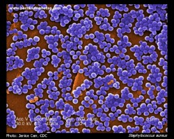Staphylococcus aureus SEM micrograph, scanning electron micrograph